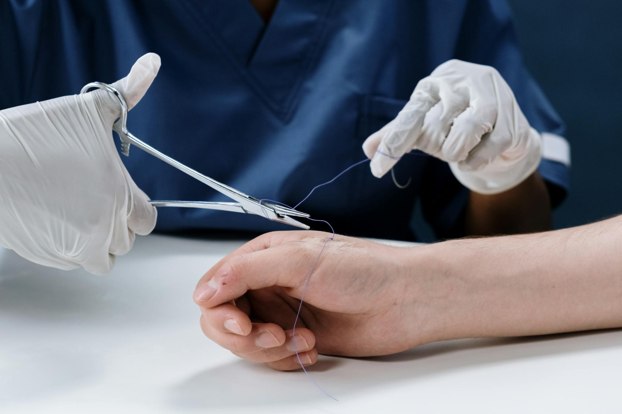A healthcare professional carefully suturing a hand, showcasing precision in medical care.