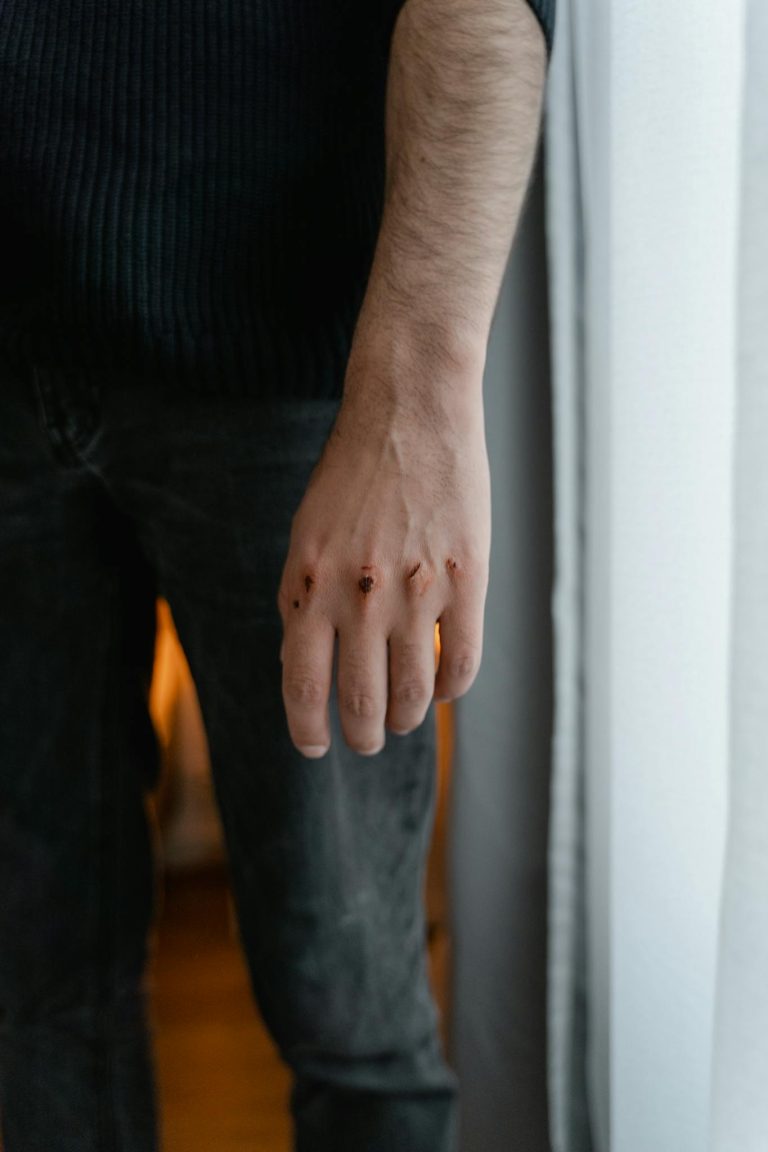 Close-up of a man's hand with visible wounds near a window indoors.